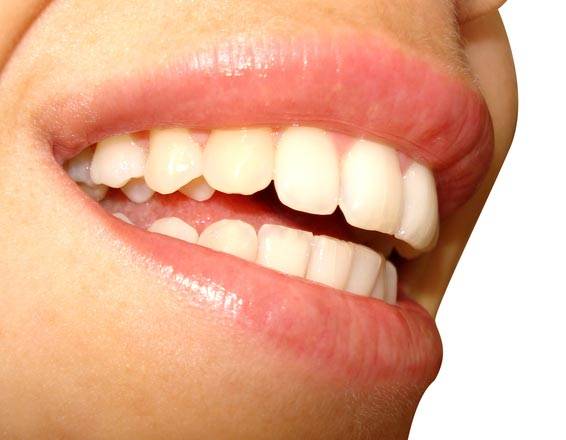 Avec de belles dents au succès
