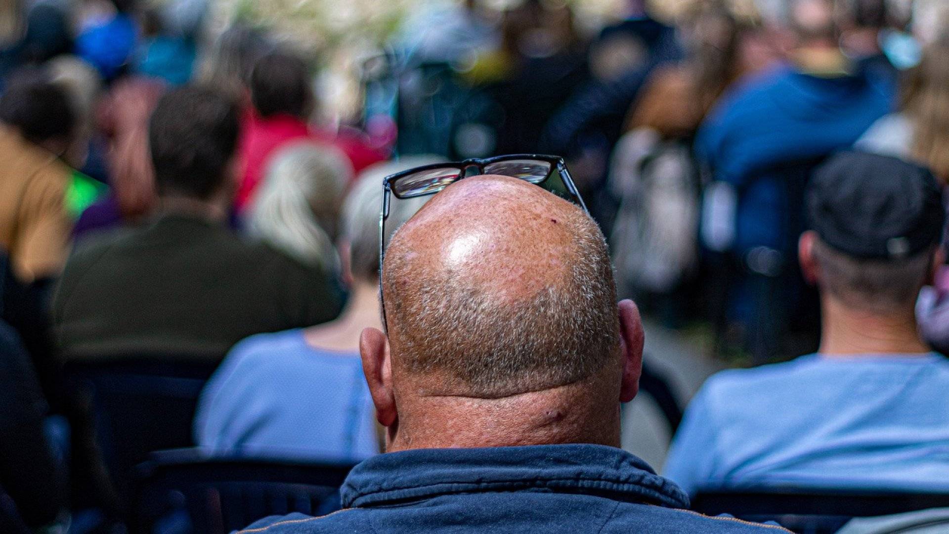 La calvitie : le problème de beaucoup d’hommes