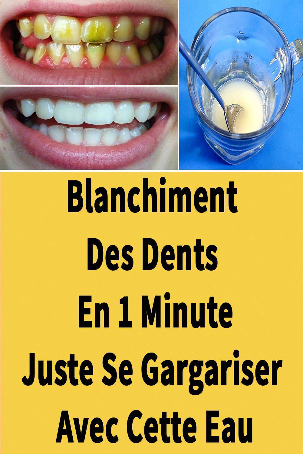 Ainsi, vous pouvez blanchir vos dents avec des produits naturels