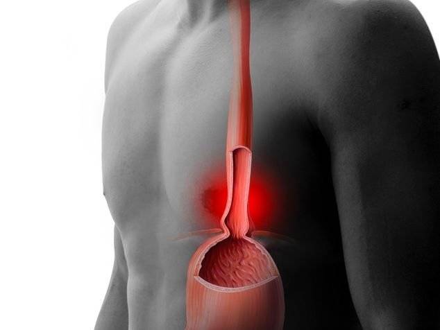Vous sentez-vous souvent un goût amer et acide ? Ce sont les symptômes du reflux